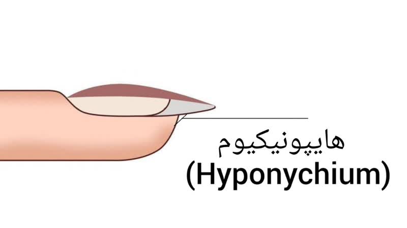 هایپونیکیوم (هایپونیچیوم Hyponychium)