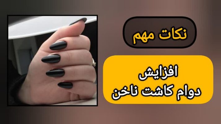 نکات مهم افزایش دوام کاشت ناخن