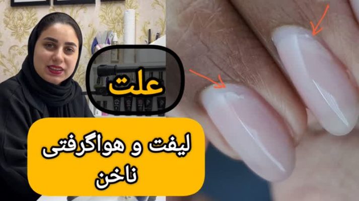 علت لیفت و هواگیری ناخن